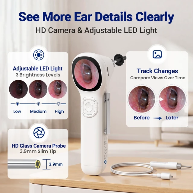 Alt view image 3 of 7 - Otoscope with Light, No App Needed, HD Screen, Ear Scope Camera for Family | Ear Camera with Earwax Removal Kit for Home Cleaning Checking, Photo & Video, 3.9mm Lens, 8GB Card, LED Light, Type-C Port