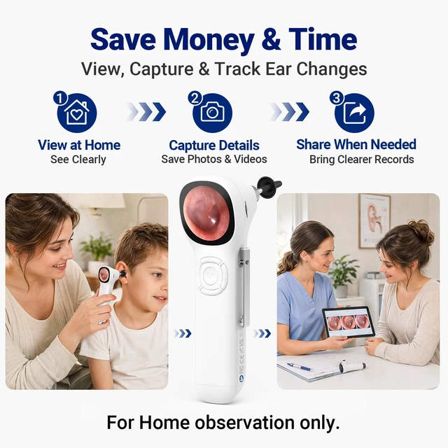 Alt view image 6 of 7 - Otoscope with Light, No App Needed, HD Screen, Ear Scope Camera for Family | Ear Camera with Earwax Removal Kit for Home Cleaning Checking, Photo & Video, 3.9mm Lens, 8GB Card, LED Light, Type-C Port