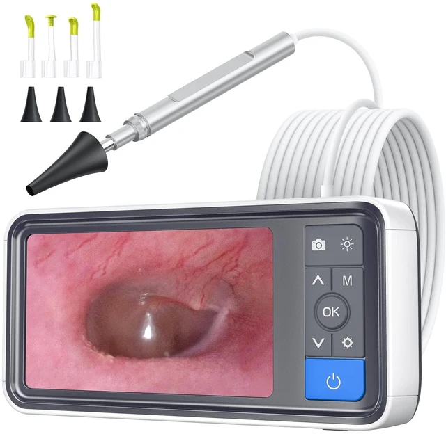Main image of Otoscope with 4.5" IPS Screen, 3.9mm Ear Camera with Gyroscope | No App /WiFi Needed, Photo & Video Recording, 32GB Card, 6 LED Lights, Easy to Use Digital Otoscope for Safe Home Ear Checker