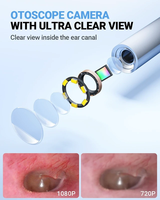 Alt view image 3 of 7 - Otoscope with 4.5" IPS Screen, 3.9mm Ear Camera with Gyroscope | No App /WiFi Needed, Photo & Video Recording, 32GB Card, 6 LED Lights, Easy to Use Digital Otoscope for Safe Home Ear Checker