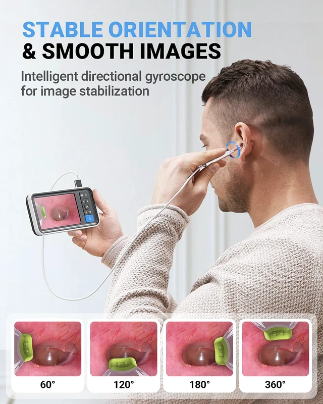 Alt view image 4 of 7 - Otoscope with 4.5" IPS Screen, 3.9mm Ear Camera with Gyroscope | No App /WiFi Needed, Photo & Video Recording, 32GB Card, 6 LED Lights, Easy to Use Digital Otoscope for Safe Home Ear Checker