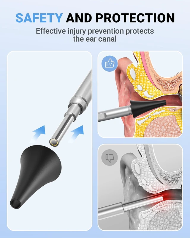 Alt view image 6 of 7 - Otoscope with 4.5" IPS Screen, 3.9mm Ear Camera with Gyroscope | No App /WiFi Needed, Photo & Video Recording, 32GB Card, 6 LED Lights, Easy to Use Digital Otoscope for Safe Home Ear Checker