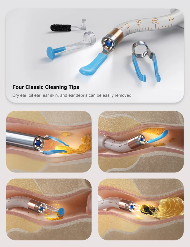 Alt view image 2 of 7 - Earsight Plus Ear Wax Removal Cleaner Tool for Adults & Kids (White) | Ear Camera with HD Visual Otoscope, Smart WiFi Earwax Cleaner Kit, Safe Silicone Flexible Scoops & Tweezers Tools