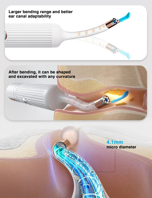 Alt view image 3 of 7 - Earsight Plus Ear Wax Removal Cleaner Tool for Adults & Kids (White) | Ear Camera with HD Visual Otoscope, Smart WiFi Earwax Cleaner Kit, Safe Silicone Flexible Scoops & Tweezers Tools