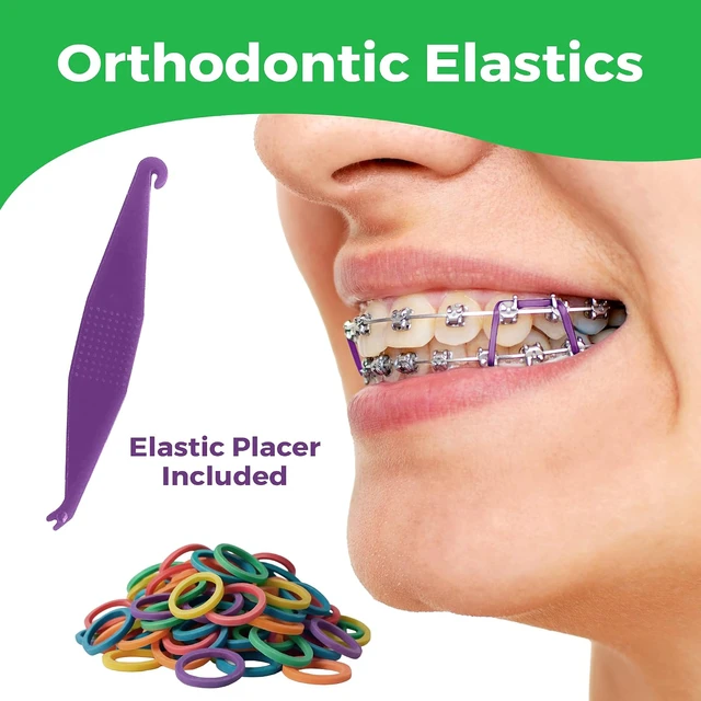 Alt view image 3 of 6 - Orthodontic Rubber Bands for Braces, 5/16in Heavy, 100 Pack, Neon