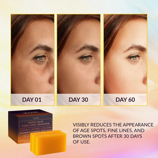 Alt view image 6 of 6 - VALITIC Kojic Acid Dark Spot Remover Soap Bars with Turmeric, 2 Pack