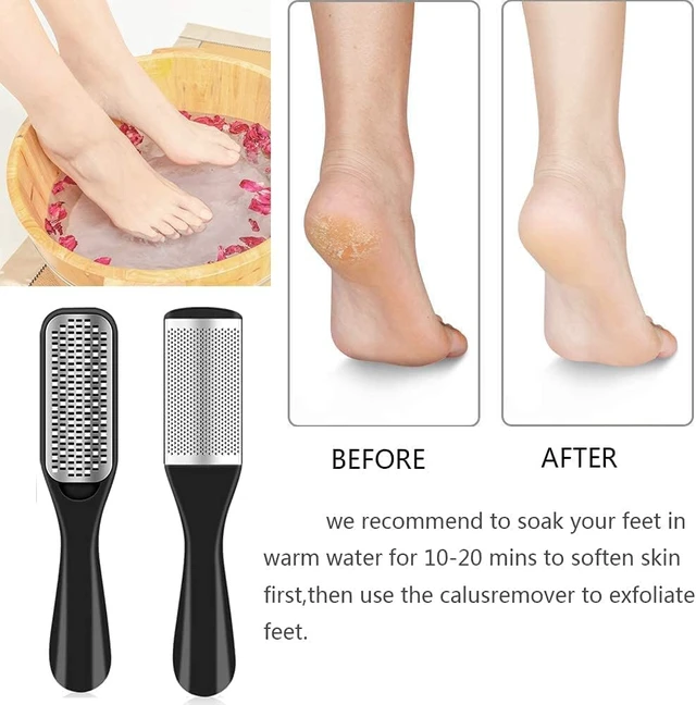 Alt view image 3 of 7 - 36 in 1 Pedicure Kit, Stainless Steel Foot Care Kit with Foot File