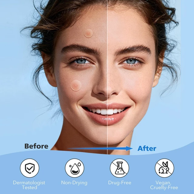 Alt view image 4 of 7 - QUSTERE Pimple Patches for Face, Hydrocolloid Acne Patches, Cute Round Shape Zit Covers, Spot Stickers with Tea Tree, Salicylic Acid & Cica Oil| 2 Sizes (9mm, 12mm) |288 Count