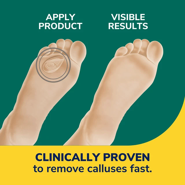 Alt view image 3 of 7 - Dr. Scholl's Callus Remover Seal & Heal Bandage with Hydrogel Technology, 4ct /Removes Calluses Fast - Provides Cushioning Protection and Friction for All-Day Pain Relief (Pack of 1, 4 Count Total)