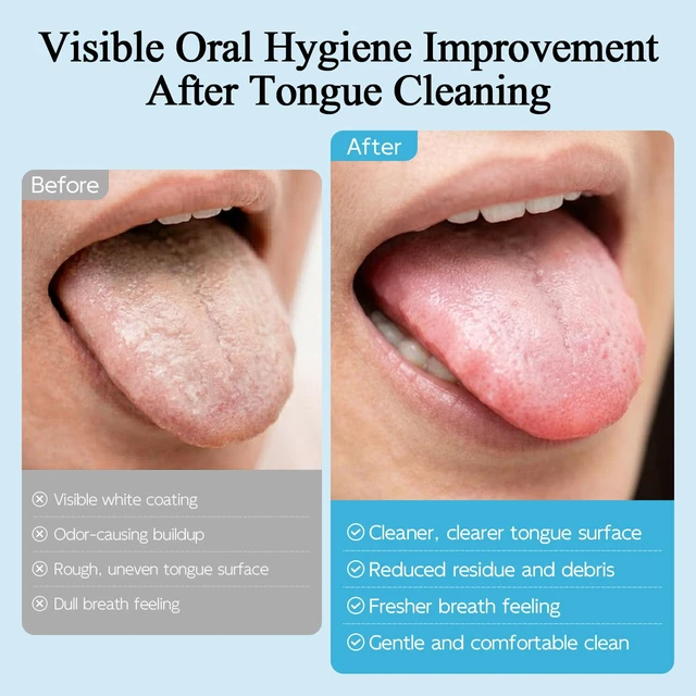 Alt view image 4 of 6 - Silicone Tongue Scraper & Brush for Adults, Soft Tongue Cleaner for Bad Breath, Gentle Flexible Bristles Remove Tongue Coating & Food Residue, Non-Metal Oral Hygiene Tool for Fresh Breath