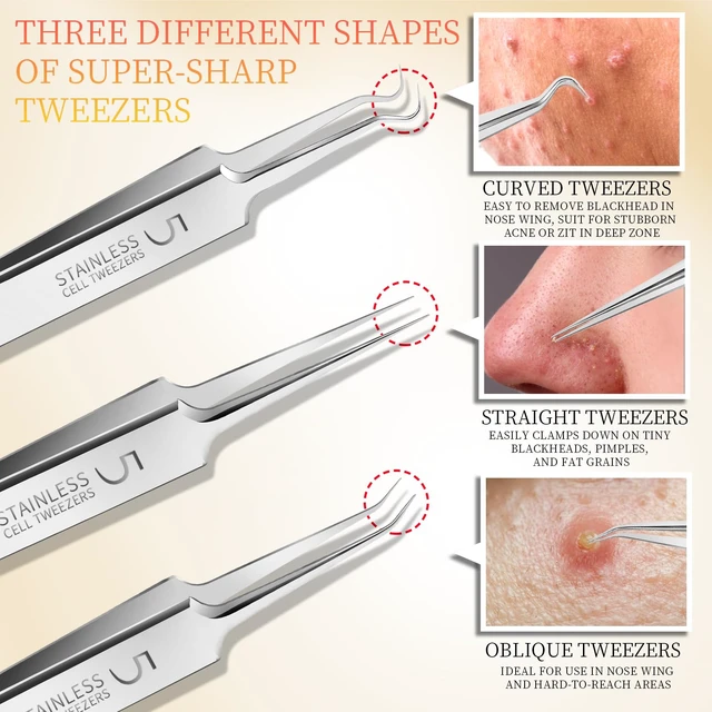 Alt view image 4 of 7 - Teenitor 4-Piece Professional Blackhead Tweezers and Pimple Popper Tool Kit, Stainless Steel, for Acne and Whitehead