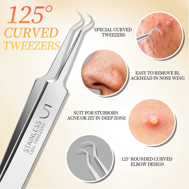 Alt view image 6 of 7 - Teenitor 4-Piece Professional Blackhead Tweezers and Pimple Popper Tool Kit, Stainless Steel, for Acne and Whitehead