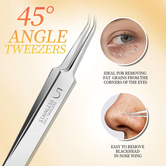 Alt view image 3 of 7 - Teenitor 4-Piece Professional Blackhead Tweezers and Pimple Popper Tool Kit, Stainless Steel, for Acne and Whitehead