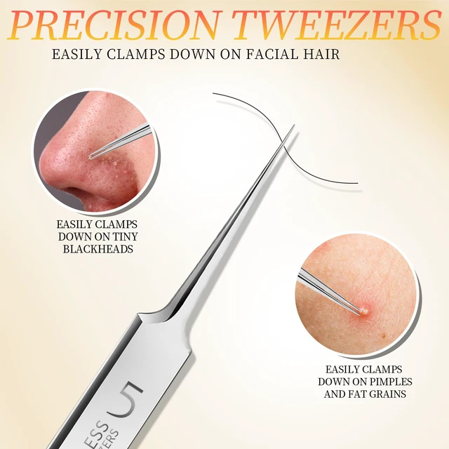 Alt view image 7 of 7 - Teenitor 4-Piece Professional Blackhead Tweezers and Pimple Popper Tool Kit, Stainless Steel, for Acne and Whitehead
