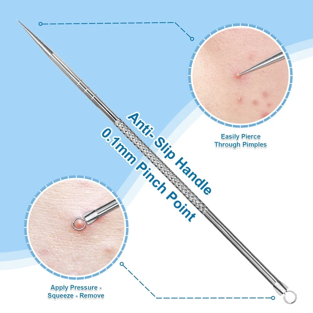Alt view image 6 of 6 - 3rd Generation Surgical Grade Stainless Steel Blackhead Remover Pimple Extractor Comedone Extractor Acne Treatment Kit - 2Pcs for Face Nose T-Zone
