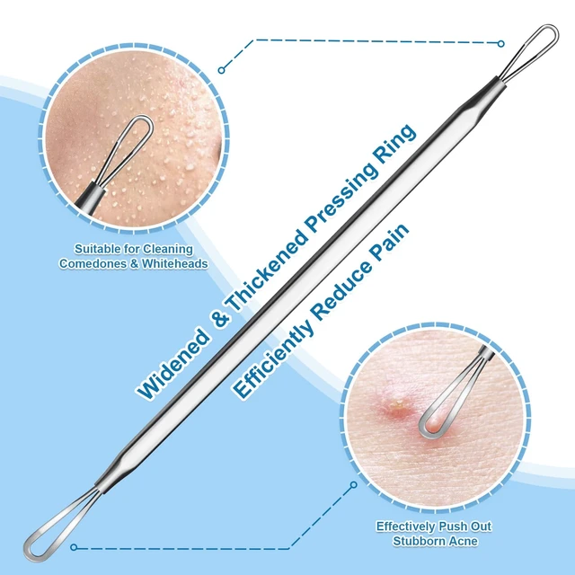 Alt view image 5 of 6 - 3rd Generation Surgical Grade Stainless Steel Blackhead Remover Pimple Extractor Comedone Extractor Acne Treatment Kit - 2Pcs for Face Nose T-Zone