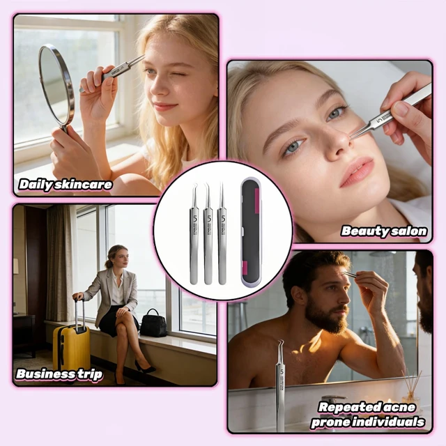 Alt view image 3 of 7 - Stainless Steel Blackhead Remover Tweezers Set, 3-Piece Pimple Extractor Tool Kit with Straight, Angled and Curved Tips, Storage Case