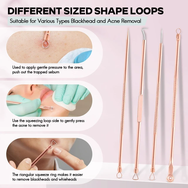 Alt view image 3 of 6 - FEITA 4-Piece Stainless Steel Blackhead Remover and Acne Pimple Popper Tool Kit for Nose and Face, Rose Gold