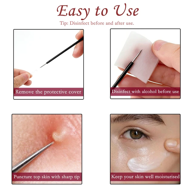 Alt view image 3 of 7 - BlingKingdom 4-Piece Pimple Popper Tool Kit with Box, Blackhead Remover