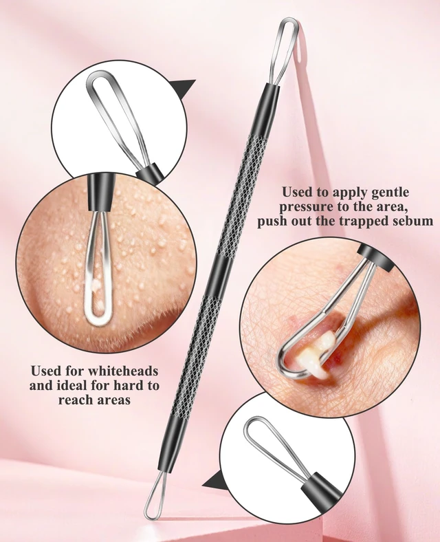 Alt view image 3 of 7 - 3PCS Stainless Steel Pimple Extractor Acne Treatment Tool, Blackhead Comedone Removal Popper for Face and Nose (Black)