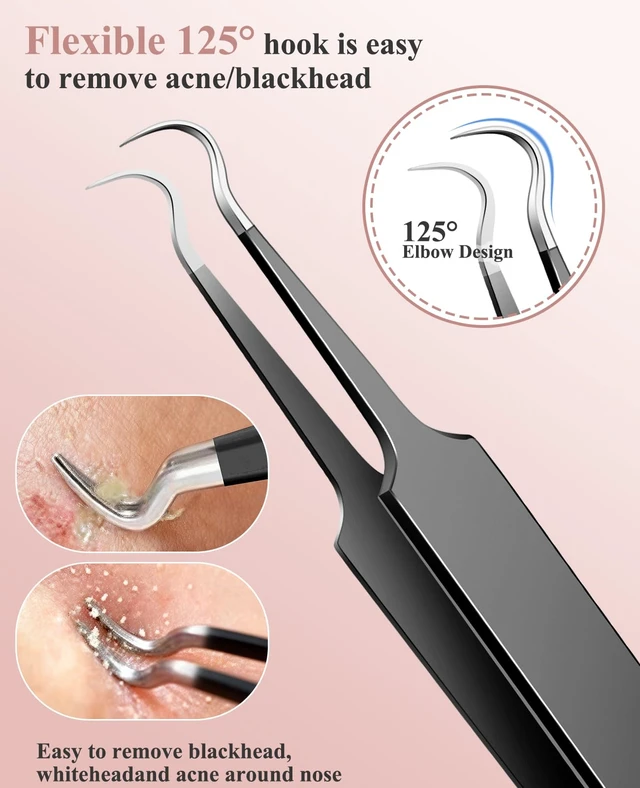 Alt view image 5 of 7 - 3PCS Stainless Steel Pimple Extractor Acne Treatment Tool, Blackhead Comedone Removal Popper for Face and Nose (Black)