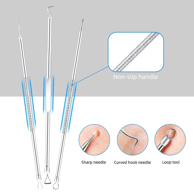 Alt view image 2 of 7 - Blackhead Extractor Kit - 5-Pack Stainless Steel Pimple Popper Tools with Case for Face and Nose