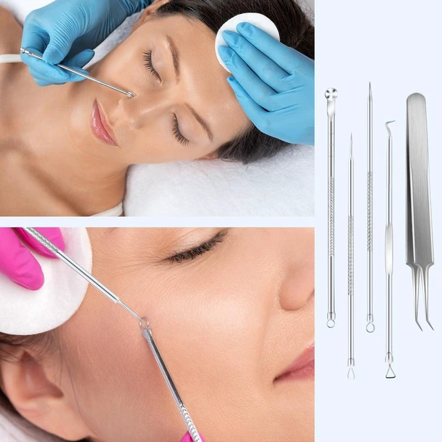 Alt view image 7 of 7 - Blackhead Extractor Kit - 5-Pack Stainless Steel Pimple Popper Tools with Case for Face and Nose