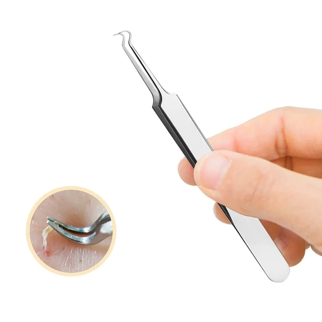 Alt view image 4 of 7 - Stainless Steel Acne Blackhead Blemish Extractor Tool Nipper Curved Tweezers For Blackhead Whitehead Pimple Removal, Silver