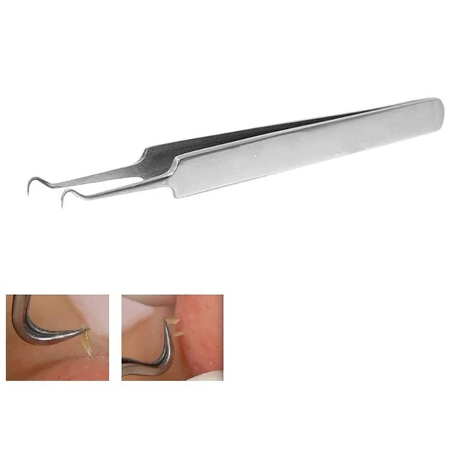 Alt view image 2 of 7 - Stainless Steel Acne Blackhead Blemish Extractor Tool Nipper Curved Tweezers For Blackhead Whitehead Pimple Removal, Silver