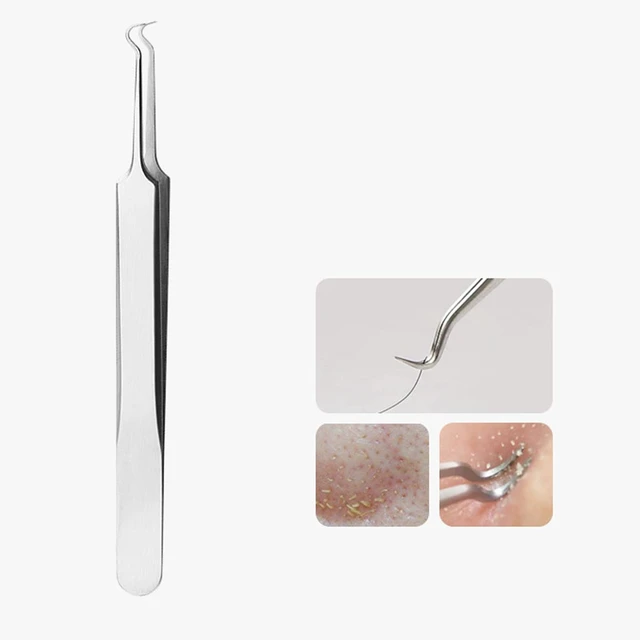Alt view image 5 of 7 - Stainless Steel Acne Blackhead Blemish Extractor Tool Nipper Curved Tweezers For Blackhead Whitehead Pimple Removal, Silver