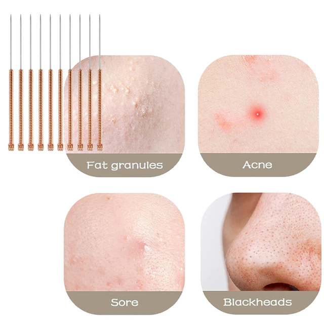 Alt view image 3 of 7 - 30Pcs Disposable Pimple Needles Blackhead And Blemish Remover