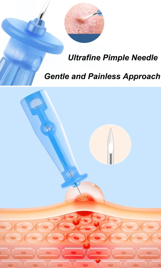 Alt view image 4 of 4 - 100PCS Sterile Acne Pimple Popper Needles, Disposable Blackhead Remover Tool Kit with Blemish Extractor