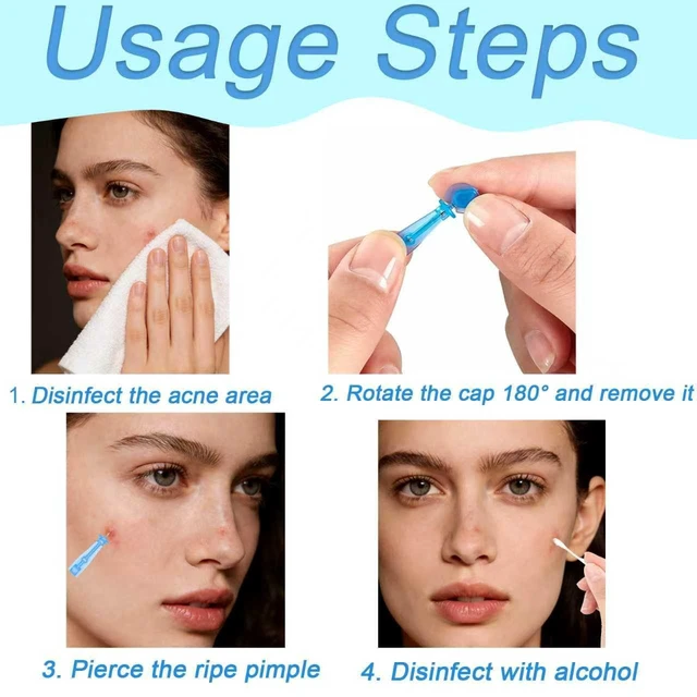 Alt view image 3 of 7 - 50pcs Disposable Blackhead and Blemish Remover Tools, 72 Dots Pimple Stickers - Sterile Needles for Acne, Whitehead, Comedone