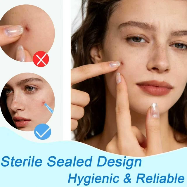 Alt view image 4 of 7 - 50pcs Disposable Blackhead and Blemish Remover Tools, 72 Dots Pimple Stickers - Sterile Needles for Acne, Whitehead, Comedone