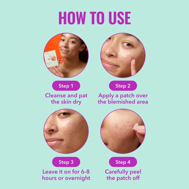 Alt view image 4 of 6 - Good Molecules Pimple Patches, Hydrocolloid Patches for Face, 60 Count