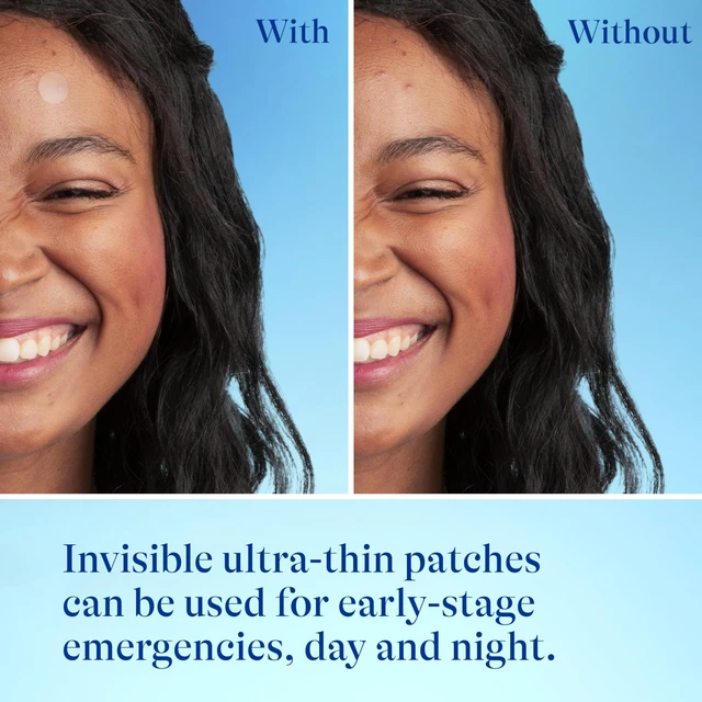 Alt view image 6 of 7 - Differin Acne Treatment Pimple Patches, Salicylic Acid & Centella, 36ct