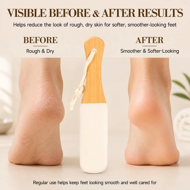 Alt view image 7 of 7 - 4Pk Pedicure Foot File Pumice Stone White Corundum Callus Dead Skin Remover