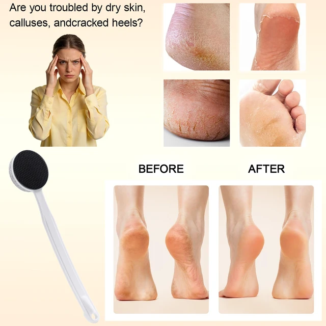 Alt view image 4 of 6 - Nano Glass and Pumice Stone for Feet Callus Remover Long Handle 13.7", Double Sided Foot File, Durable Foot Scrubber Pedicure Tool for Hard & Dead Skin Remover, Soft and Smooth Feet, White