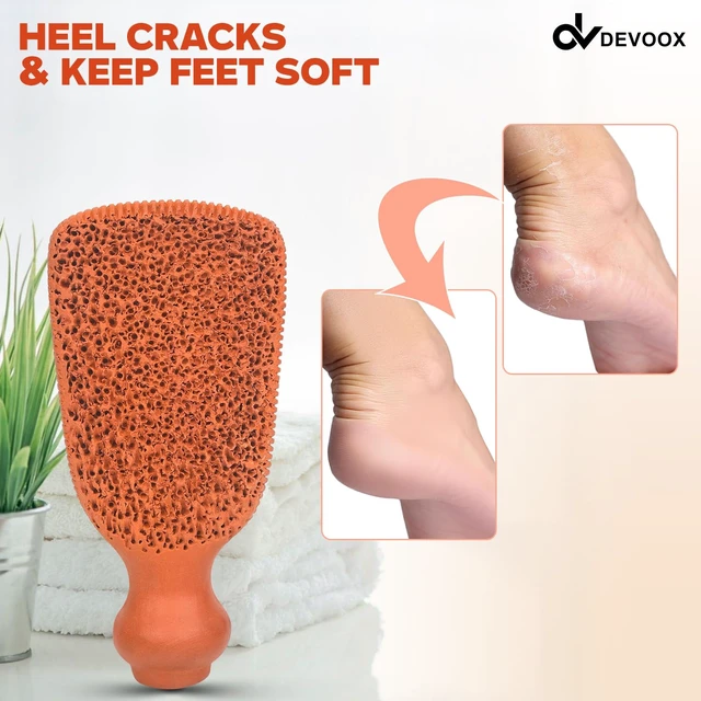 Alt view image 6 of 6 - Pumice Stone Natural for Shower Dual Sided Foot Exfoliator, Foot Scrubber for Dead Skin, Callus Remover for Feet, Hard Skin Remover, Pedicure Tool for Men & Women