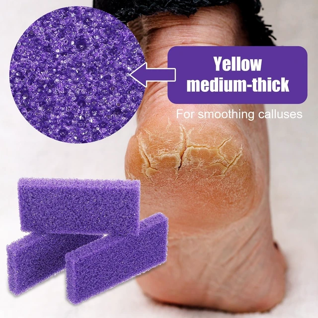 Alt view image 4 of 7 - 100pcs Foot Pumice Stone Bulk,Exfoliating Disposable Foot Pumice Stones,Feet Callus Remover Pedicure Tool,Purple Cleaning Stone Sponge,Double-Sided Scrub Feet Brush Heel Cuticle Bath Spa