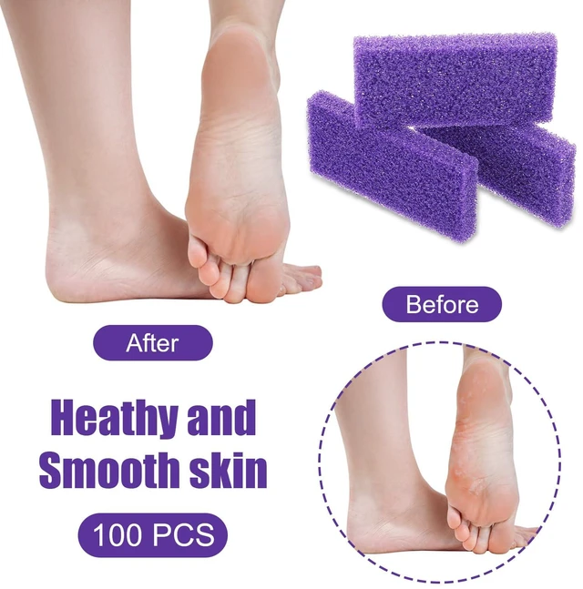 Alt view image 5 of 7 - 100pcs Foot Pumice Stone Bulk,Exfoliating Disposable Foot Pumice Stones,Feet Callus Remover Pedicure Tool,Purple Cleaning Stone Sponge,Double-Sided Scrub Feet Brush Heel Cuticle Bath Spa