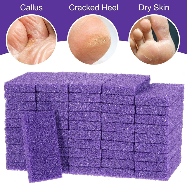 Alt view image 6 of 7 - 100pcs Foot Pumice Stone Bulk,Exfoliating Disposable Foot Pumice Stones,Feet Callus Remover Pedicure Tool,Purple Cleaning Stone Sponge,Double-Sided Scrub Feet Brush Heel Cuticle Bath Spa