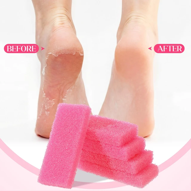 Alt view image 4 of 7 - 100 Pcs Pumice Stone for Feet, Pink | Disposable Pedicure Foot Scrubber with Callus, Dead Skin and Heel Care, Spa Bath Exfoliator, Natural Volcanic Stone