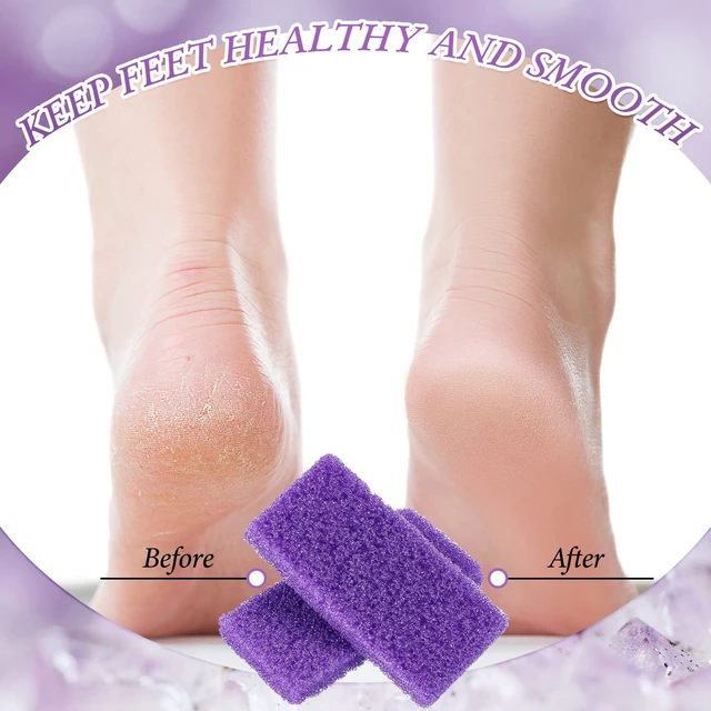 Alt view image 3 of 5 - 200 Pcs Disposable Pumice Stones for Feet, Professional Pedicure Callus Remover Blocks for Spa Salon Pedicure Supplies, Foot Exfoliating Scrubber for Dead Skin and Heel Care