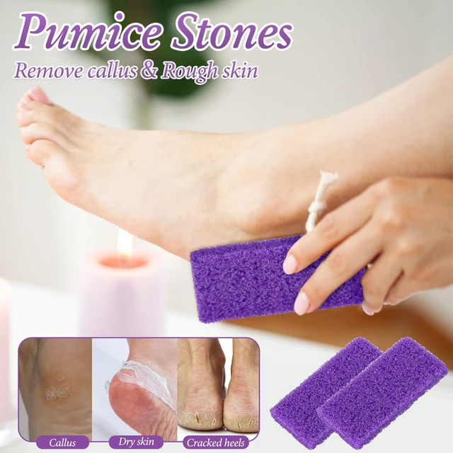 Alt view image 5 of 5 - 200 Pcs Disposable Pumice Stones for Feet, Professional Pedicure Callus Remover Blocks for Spa Salon Pedicure Supplies, Foot Exfoliating Scrubber for Dead Skin and Heel Care