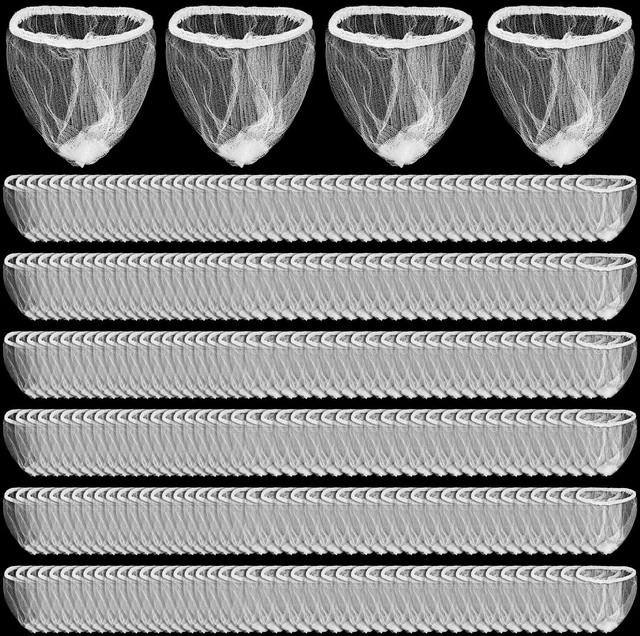 Main image of 1000 Pack Disposable Sink Strainer Bags, Ultra-Fine Nylon Mesh Drain Catcher for Kitchen Sink, Elastic Disposable Strainer Filters for Food Waste, Hair & Debris, Universal Fit for Most Drains