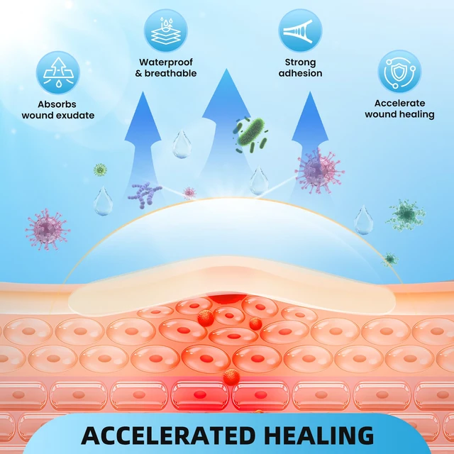 Alt view image 5 of 7 - Hydrocolloid Roll Bandages, 2IN x 16FT Extra Large Hydrocolloid Patch with Self-Adhesive, Ultra Absorbent, Cut-to-Size, Flexible & Waterproof for Burn, Blister, Acne Care