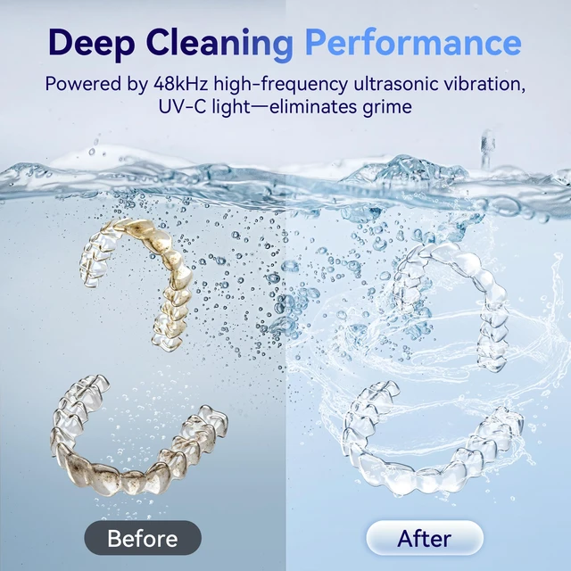 Alt view image 5 of 7 - Ultrasonic Retainer Cleaner Machine 48kHz, Dental Ultrasonic Care Cleaner Ultrasonic Retainer Cleaner for Dentures, Aligners, Mouth Guards, Toothbrush Heads and Jewelry with 200ML Capacity