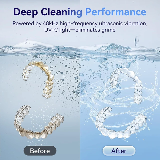 Alt view image 5 of 7 - Ultrasonic Retainer Cleaner Machine 48kHz, Dental Ultrasonic Care Cleaner Ultrasonic Retainer Cleaner for Dentures, Aligners, Mouth Guards, Toothbrush Heads and Jewelry with 200ML Capacity