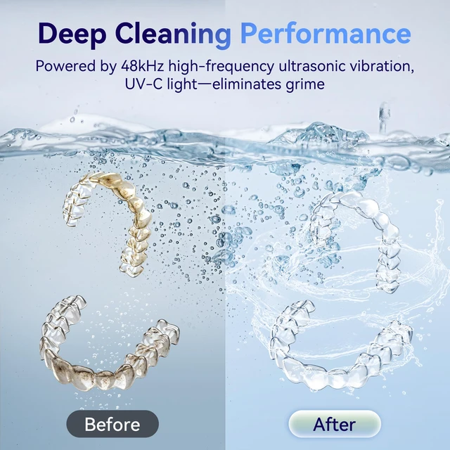 Alt view image 5 of 7 - Ultrasonic Retainer Cleaner Machine 48kHz, Dental Ultrasonic Care Cleaner Ultrasonic Retainer Cleaner for Dentures, Aligners, Mouth Guards, Toothbrush Heads and Jewelry with 200ML Capacity